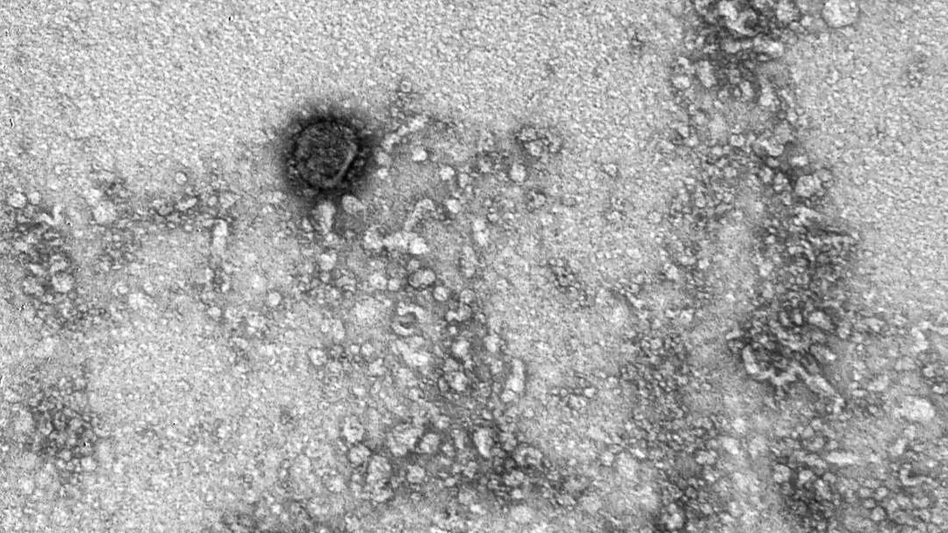 Resultado de imagem para Cientistas russos sequenciam genoma e tiram primeira foto do coronavírus
