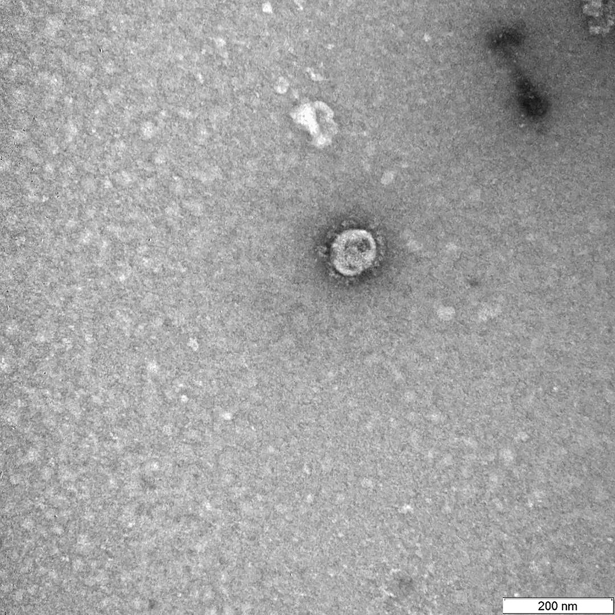Resultado de imagem para Cientistas russos sequenciam genoma e tiram primeira foto do coronavírus