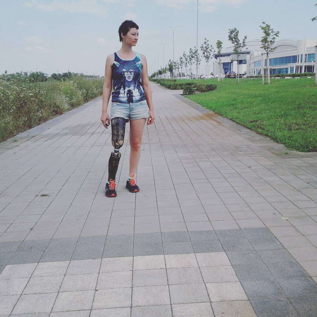 Russian cancer survivor: I hope my Instagram page will inspire the disabled